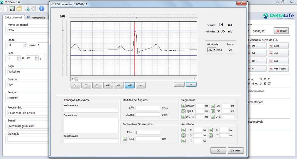 Monitor multiparamétrico DL 1000 touch screen vet - Imagem 12