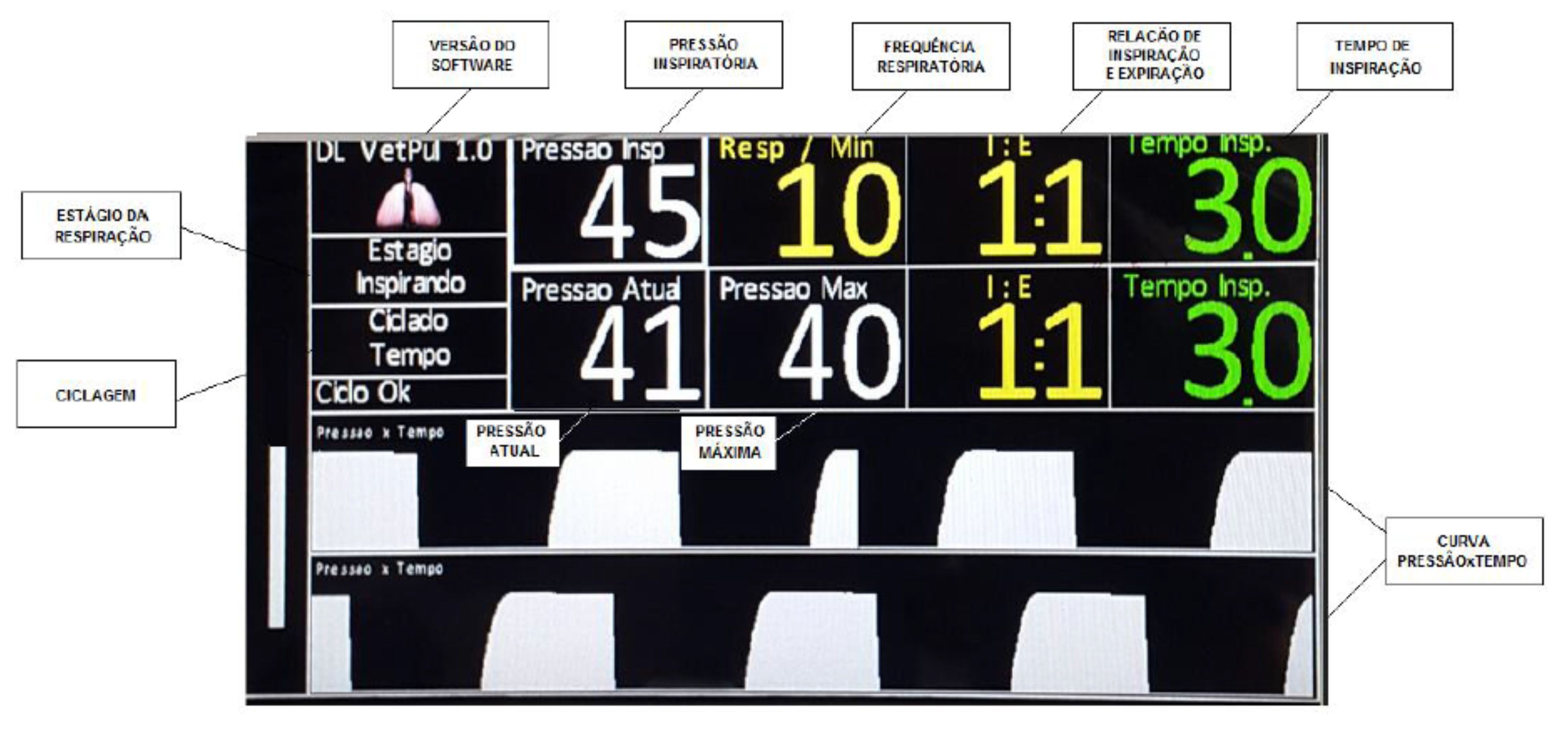 Aparelho de anestesia inalatória DL730 - Imagem 6