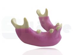 Mandíbula Com Alguns Dentes e Gengiva - 4012G