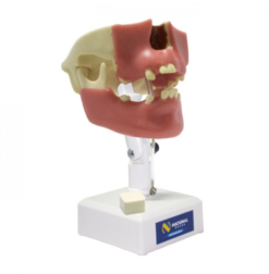 4005 G -Manequim Pré-Molar Com Gengiva