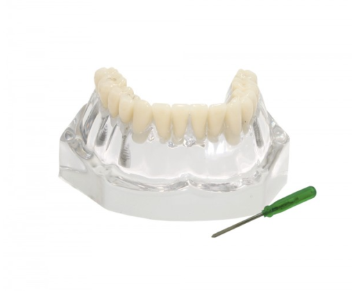 9570 – Mandíbula Acrílica Com Dentes e 3 Implantes